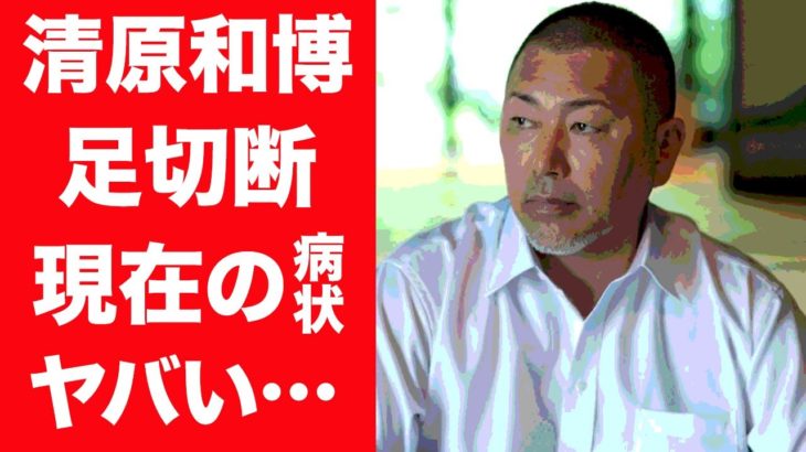 【驚愕】清原和博の足を切断するほどの現在の病状に涙が溢れた…！『お祭り男』の愛称で親しまれる元プロ野球選手の長渕剛との確執や子供達の現在に一同驚愕…！